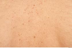 Photo Textures of Human Skin